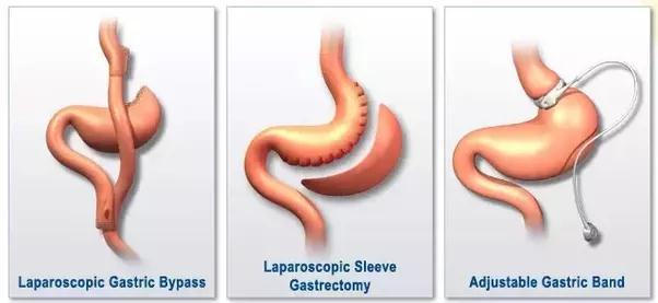 THREE COMMON TYPES OF PROCEDURES